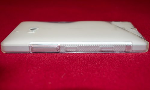 Sline Case 11.jpg